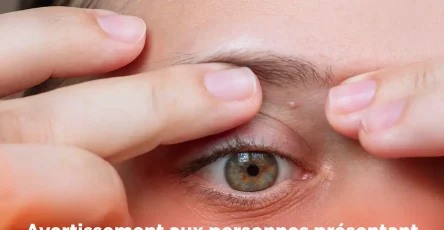 Avertissement aux personnes presentant de petites taches blanches apparaissant sur tout le corps un medecin explique comment sen debarrasser.jpg (1)