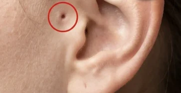 Decouvrez la signification de cette marque sur loreille.jpg