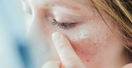 Comment soigner eczema naturel 750x410