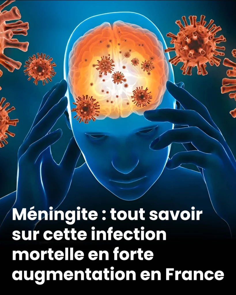 Meningite tout savoir sur cette infection mortelle en forte augmentation en france 819x1024.jpg