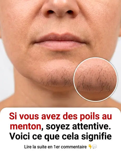 Si vous etes une femme avec des poils au menton voici ce que cela signifie vraiment.jpg