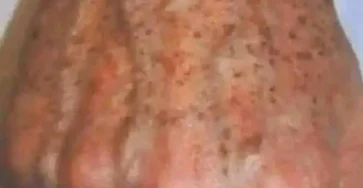 Pourquoi les taches apparaissent sur les mains et comment les eliminer 1.jpg