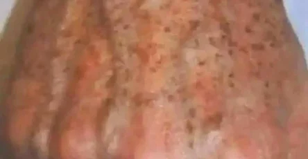 Pourquoi les taches apparaissent sur les mains et comment les eliminer 1.jpg