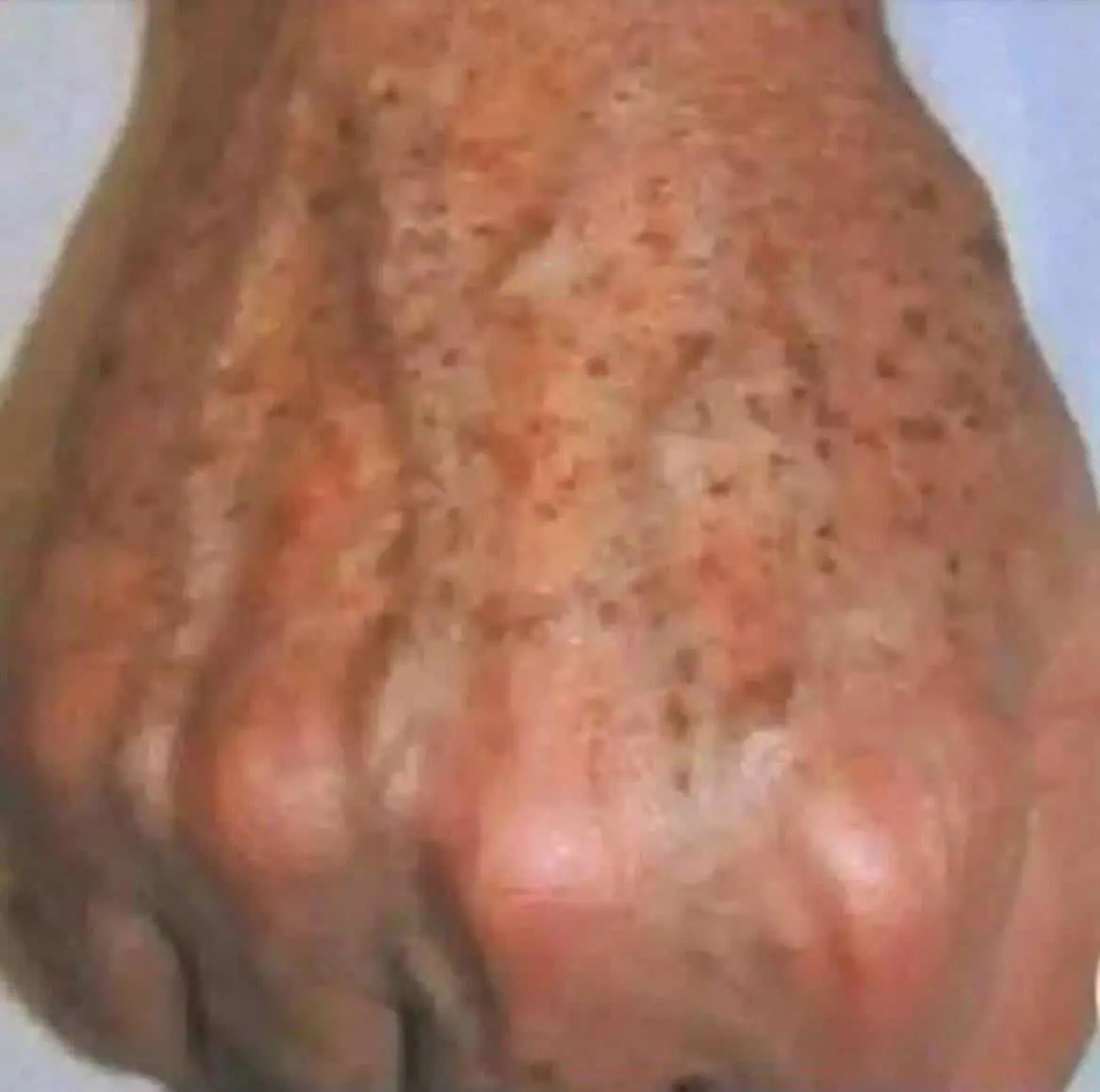 Pourquoi les taches apparaissent sur les mains et comment les eliminer 1.jpg