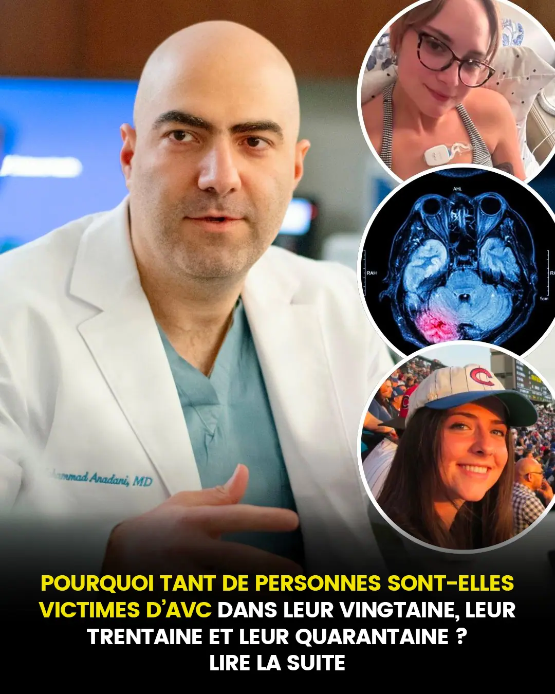 Pourquoi tant de personnes sont victimes davc dans la vingtaine la trentaine et la quarantaine.jpg