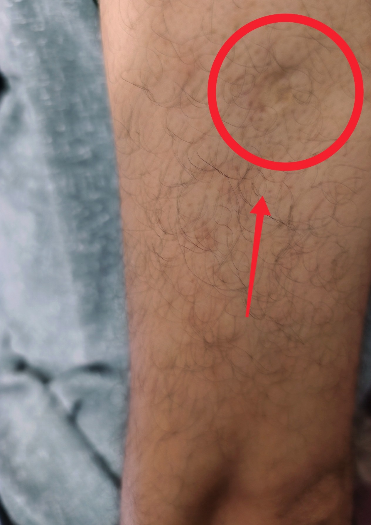 1000027828