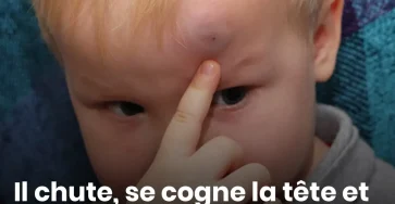 Il chute se cogne la tete et decede quelques heures plus tard les 11 signes dalerte a surveiller chez un enfant selon un medecin.jpg