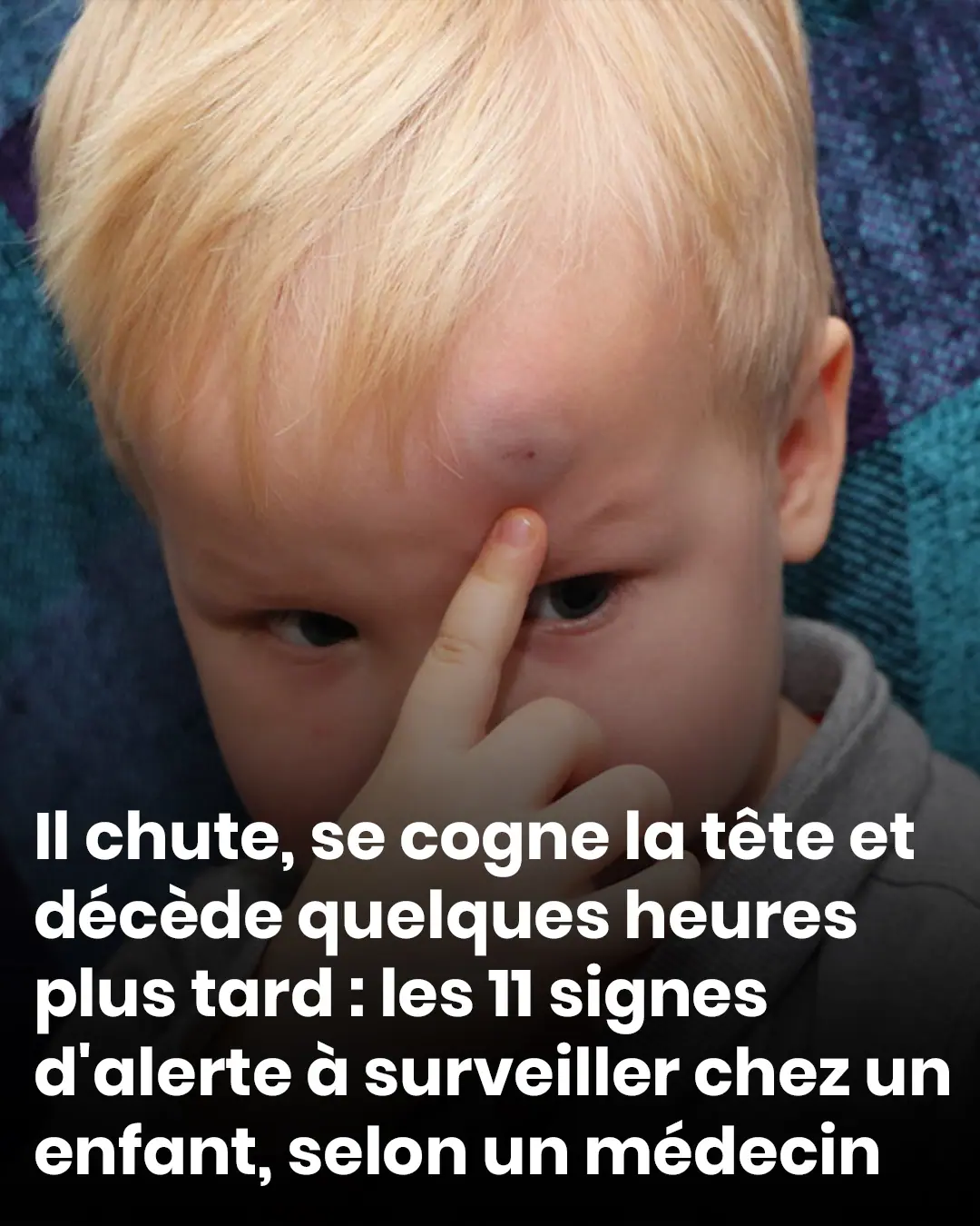 Il chute se cogne la tete et decede quelques heures plus tard les 11 signes dalerte a surveiller chez un enfant selon un medecin.jpg