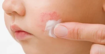 Young adult mother finger applying 260nw