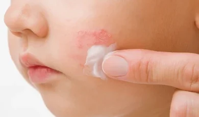 Young adult mother finger applying 260nw