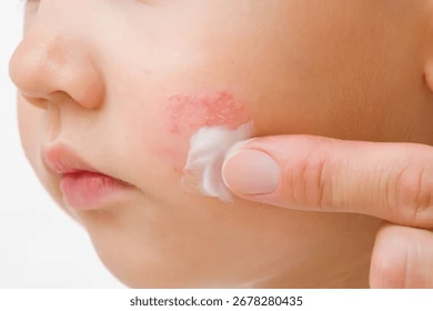 Young adult mother finger applying 260nw