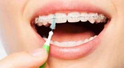 Photo d une personne nettoyant ses interdentaires 400x220